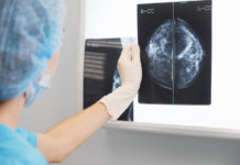 Google : des algorithmes pour détecter le cancer du sein