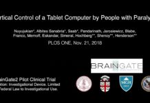 Le projet de recherche BrainGate 2 développe la première interface ordinateur-cerveau destinée aux tétraplégiques