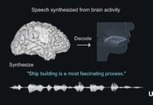 Des chercheurs développent un implant capable de transformer les signaux du cerveau en parole synthétisée