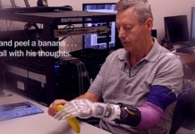 Un bras prothétique permettant aux patients de ressentir à nouveau la sensation du toucher vient d’être développé