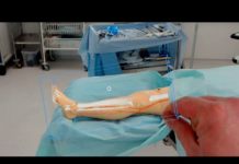 Visionner l’intérieur du corps des patients avec les HoloLens avant d’opérer