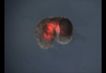 Xenobot, le premier robot conçu à partir de cellules vivantes