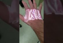 This technology by AccuVein creates a real-time visual map of the veins on the surface of the skin