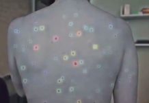 Les chercheurs du Massachusetts Institute of Technology utilisent l’IA pour détecter un cancer