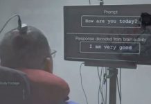 Cet homme gravement paralysé communique via une neuroprothèse vocale