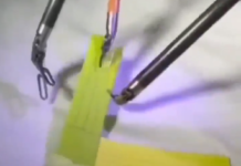 Le robot médical Da Vinci permet de réaliser une opération à distance