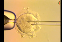 Un bébé créé avec 3 ADN différents