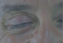 Tu as plus de 40 ans… et tu vois flou ? Fini les lunettes (et les lentilles) avec ce collyre révolutionnaire