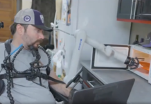 Alex Conley contrôle désormais un bras robotique… par la pensée.
